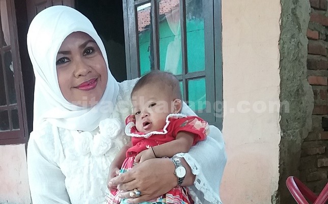 Ketua Biro Pemenangan Pemilu (Bippilu) Dapil II DPD PAN, Dwi Mulyani saat menggendong Nuriyani (8 bulan) bayi penderita gizi buruk.