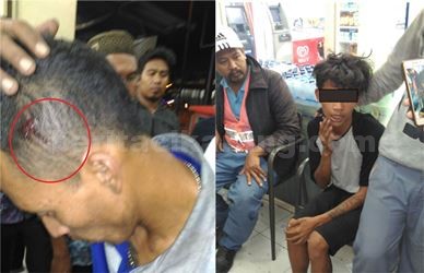 Foto Kiri : Korban AG mengalami luka sobek di bagian kepala sebelah kiri akibat pemulukan yang dilakukan RS. | Foto Kanan : Tersangka RS saat diamankan warga sebelum akhirnya diserahkan ke Polsek Cikarang.