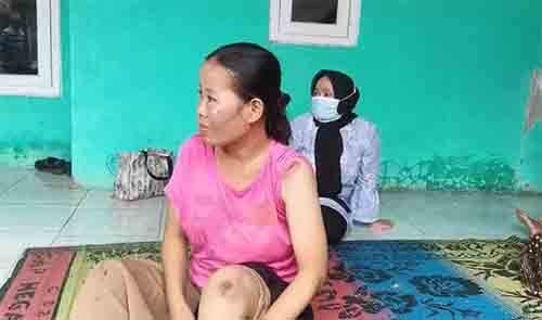 Suharlina saat menunjukan luka di sejumlah bagian tubuhnya usai menjadi korban pembegalan di Jl. Pisangan, Desa Karangpatri, Kecamatan Pebayuran, Sabtu (12/02) pagi.
