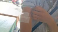 Selain kehilangan motor, Deden Rahmat Hidayat (23) juga mengalami luka bacok di bagian tangan kanan usai menjadi korban begal di Kawasan Jurong, Desa Pasirgombong, Kecamatan Cikarang Utara Kabupaten Bekasi, Sabtu (04/05) dinihari.