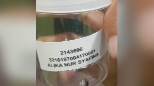 Untuk mengungkap asal-usul peluru dan mengidentifikasi senjata yang digunakan, proyektil yang bersarang di tubuh korban kini diamankan sebagai barang bukti dan akan menjalani uji balistik di Laboratorium Forensik (Labfor).