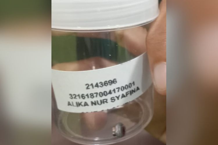 Untuk mengungkap asal-usul peluru dan mengidentifikasi senjata yang digunakan, proyektil yang bersarang di tubuh korban kini diamankan sebagai barang bukti dan akan menjalani uji balistik di Laboratorium Forensik (Labfor).