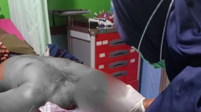 Cekcok usai menghadiri resepsi pernikahan berujung aksi kekerasan terjadi di Desa Sindangsari, Kecamatan Cabangbungin, Kabupaten Bekasi. Dua pria ditangkap polisi setelah diduga menghantam kepala seorang warga menggunakan batu hingga korban mengalami luka berdarah.
