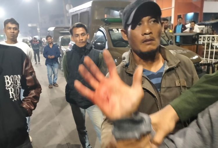 pASAR sgc PARKI REBUTAN Bentrokan antara dua kelompok massa terjadi di Jalan RE Martadinata Nomor 58, Desa Cikarang Kota, Kecamatan Cikarang Utara, Kabupaten Bekasi, Selasa (28/10) malam. Akibat kejadian itu, seorang pria berinisial TN (31) mengalami luka robek pada telapak tangan kanan yang diduga akibat sabetan senjata tajam.